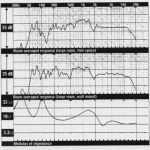 Sintra, Hi-Fi Choice Review, Jan 91 graphs